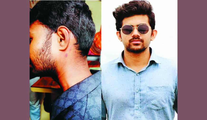 সহপাঠীকে থাপ্পড় দিয়ে কানের পর্দা ফাটানোর  অভিযোগ যবিপ্রবি শিক্ষার্থীর বিরুদ্ধে